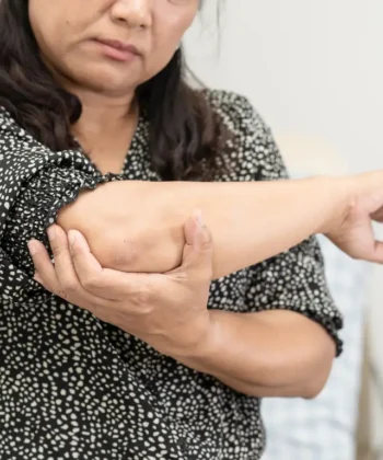Middle-aged woman holding her painful elbow, possibly experiencing symptoms of a hyperextended elbow.